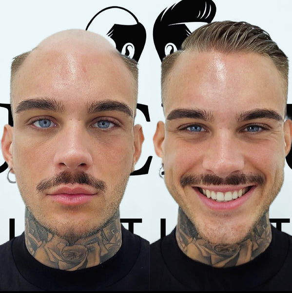 Men Hair System